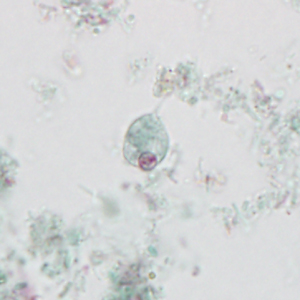 May - 2015 - Case #395