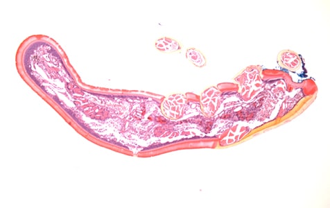 A skin biopsy specimen was collected from the clavicle region of a 45-year-old male who presented with what appeared to be a pigmented lesion. The patient resides in Kentucky and has no known international travel. 