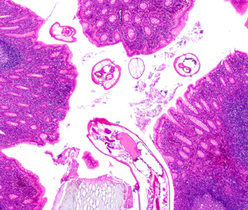 July - 2015 - Case #400