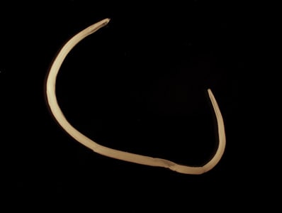 A worm approximately three centimeters long was observed and removed during a routine colonoscopy of a 54-year-old man from Scandinavia.  The worm was sent to the CDC-DPDx Team for identification. 