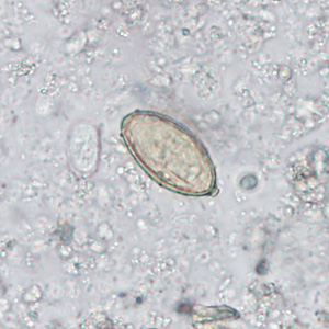 August - 2015 - Case #402