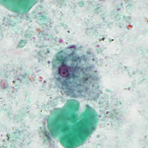 September - 2015 - Case #404