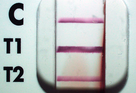 Case413_A.jpg Figure A