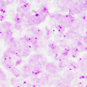 Case413_B.jpg Figure B