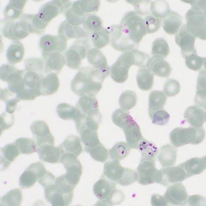 Case413_C.jpg Figure C