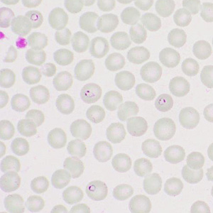 Case413_I.jpg Figure I