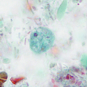 February - 2016 - Case #414