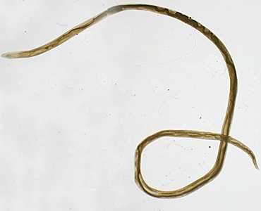 April - 2016 - Case #417