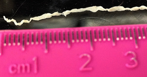 August - 2016 - Case #425