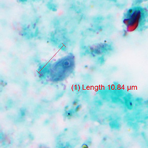 October - 2016 - Case #429