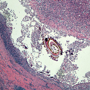 November - 2016 - Case #432