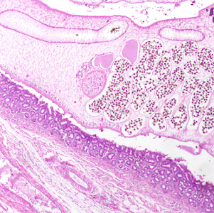 JANUARY - 2017 - Case #436