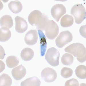 May - 2017 - Case #443 Case 443