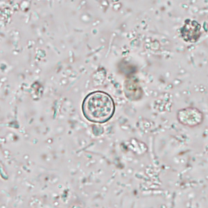 JUNE - 2017 - Case #445 case445