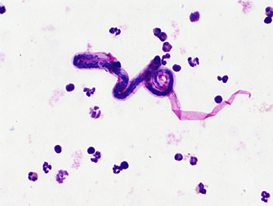 JUNE - 2017 - Case #446 case446