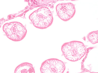 Case448_B parasitic image