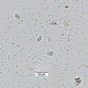 Case449_D parasitic image