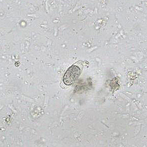 Case452_A Case Study Image