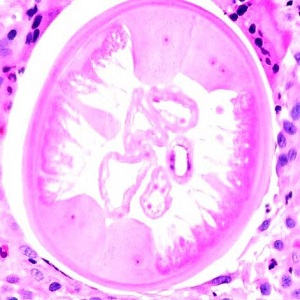 Case454_C parasitic image