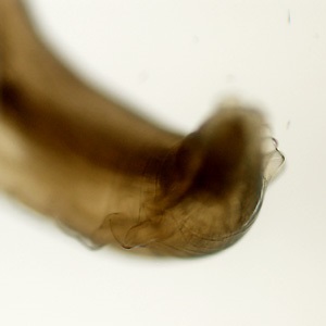 Case455_C Parasitic image