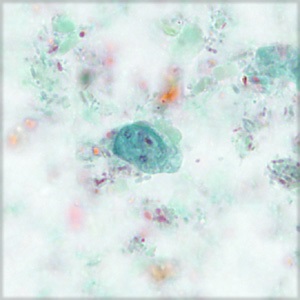 Case456_D parasitic image