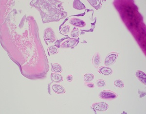 Case458_B parasitic image