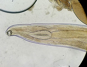 Case 473_A parasitic image