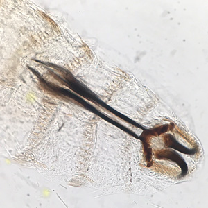 Case459_C parasitic image