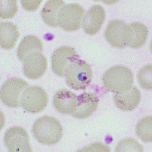 Case460_D parasitic image