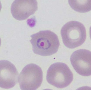 FEBRUARY - 2018 - Case #461 Parasitic image