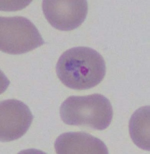 Case461_B Parasitic image