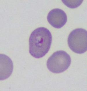 Case461_G Parasitic image