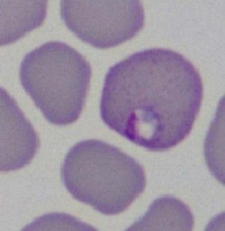 Case461_H3 Parasitic image