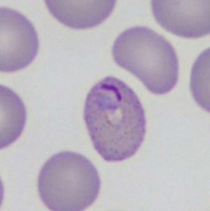 Case461_I Parasitic image