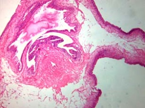 Case462_A Parasitic image