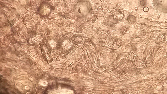 MARCH - 2018 - Case #463 Parasitic Image