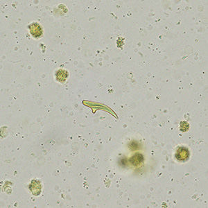 OLYMPUS DIGITAL CAMERA Parasitic image