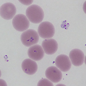 Case469_C Parasitic image