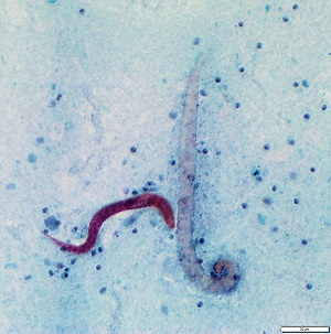 Case470_F parasitic image