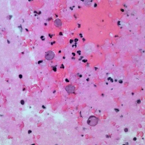 JULY - 2018 - Case #471 parasitic image