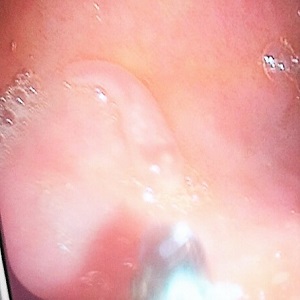 JULY - 2018 - CASE #472 parasitic image