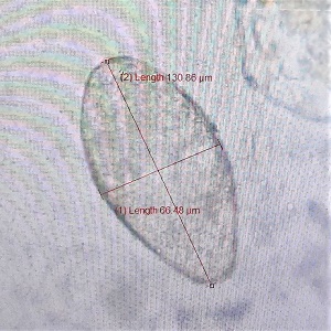 Case472_E parasitic image