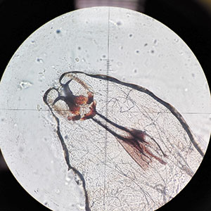 Case476_B parasitic image