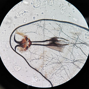 Case476_C parasitic image