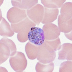 OCTOBER - 2018 - CASE #478 parasitic image