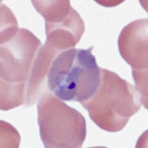 Case478_B parasitic image