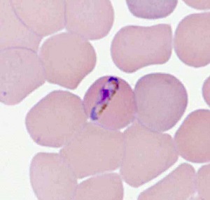 Case478_F parasitic image