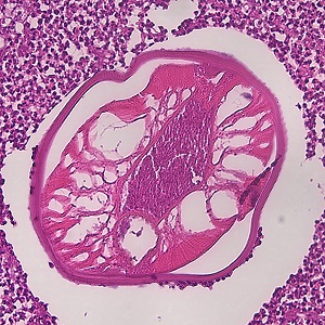 Case479_B parasitic image