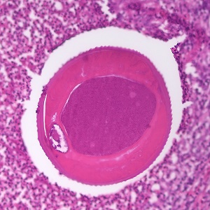 Case479_C parasitic image