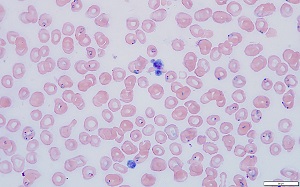 Case480_D parasitic image